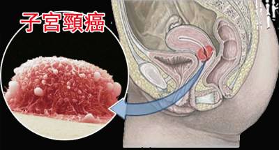 「海帶加一物」專治肝病!這麼好的湯,竟然沒有人知道!!