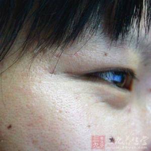 這裡有「痣」的人,千萬要小心了!!痣長在不對的地方,真的很可怕…胸前 鼻子 耳朵…