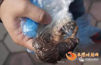 驚悚!女子手術後身體散發惡臭!20天後下體竟然掉出…讓她一看就暈倒了!!