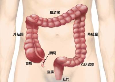 驚!16歲少女得「大腸癌」晚期!原因竟是平常的這個習慣...很多人都會這樣,一定要分享出去!
