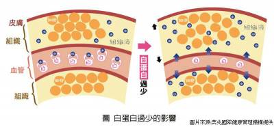 身體水腫恐因白蛋白低下 喝水也會胖!