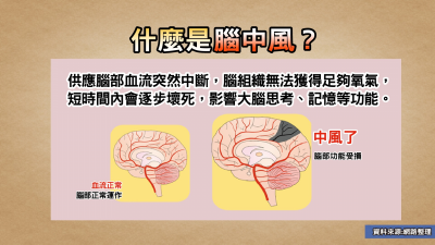運動撞頭竟語無倫次 專家教你揪出「大腦未爆彈」