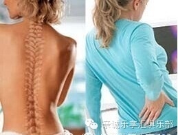 腰間盤突出不是病,千萬別給醫生切啦