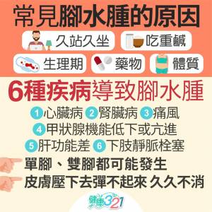 別輕忽!腳水腫恐是心臟衰竭 出現4症狀千萬別拖