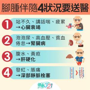 別輕忽!腳水腫恐是心臟衰竭 出現4症狀千萬別拖