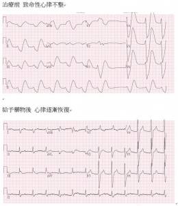 精準研判藥物治療 急診將高血鉀病患從鬼門關救回