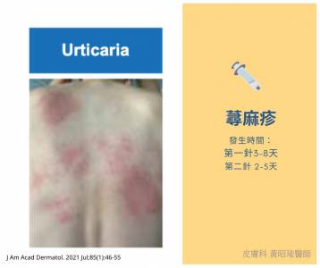 打武肺疫苗「皮膚」7症狀!醫:小紅點快就醫