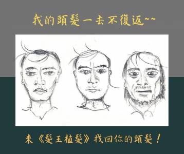 台灣植髮診所「髮王」助你找回年輕頭髮自信