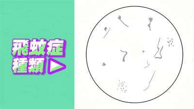 影/「飛蚊症」超擾人!護理師:黑點多恐視網膜剝離