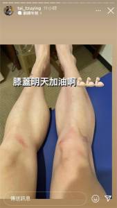 東奧/戴資穎「纏鬥」伊瑟儂!膝蓋傷勢曝光