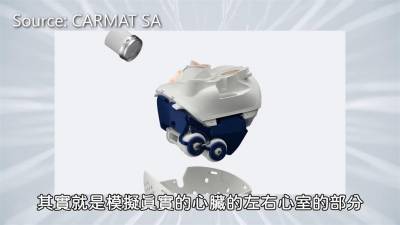 影/機器戰警4你?全人工心臟要價660萬交易成功