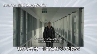 影/機器戰警4你?全人工心臟要價660萬交易成功