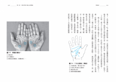 蔡依林也在瘋《算病》!揉合現代大數據與古老中醫智慧,幫你看出罹癌好發期?