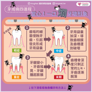 糖尿病是口腔健康殺手!?糖尿病影響口腔健康5大因素
