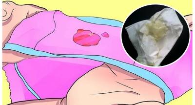 關於女性妹妹分泌物的事!(如何保養請讀這篇文!很重要,女生們別害羞!)