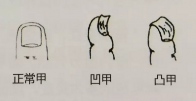 指甲上有大秘密!身體好不好,它都知道!