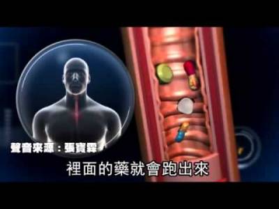 太嚇人 這名男子以99 人都會用的方式吞藥~居然食道爛掉險慘死 最後竟切某個部位來取代
