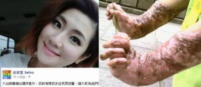 創傷症候群患者「那是個走出來也痛苦,走不出來也痛苦的世界。」