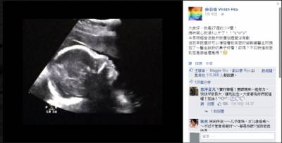 太棒了 徐若瑄公佈「消水腫」祕方 原來只要吃這個 讓她整個去除水腫 網友看了超感激!