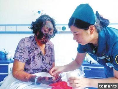 這名老婦人走在路上突然臉部焦黑,女兒急忙送去醫院才知道...原來媽媽在出門前吃了某樣食物的緣故......