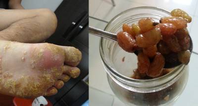 很神!這兩種「東西」加一起每天一杓,就能治皮膚病 老花眼 預防癌症 不復胖!至少十六種好處!恨太晚知道了!