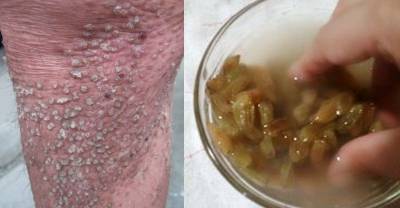 很神!這兩種「東西」加一起每天一杓,就能治皮膚病 老花眼 預防癌症 不復胖!至少十六種好處!恨太晚知道了!