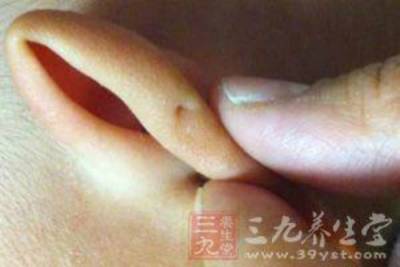 身體「這裡」捏一下,百病全消!老中醫近乎失傳的方法...分享出去!功德無量!