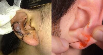 「耳洞」為何會變臭,答案竟然這麼恐怖!其實只要多一個動作....再也不會發生了!